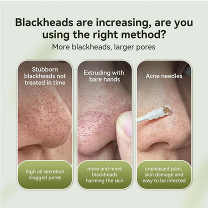 LANBENA 2.0 Blackhead Nose Plants Pore Strips(1.03 Oz), 60pcs Nose Strips for Bl